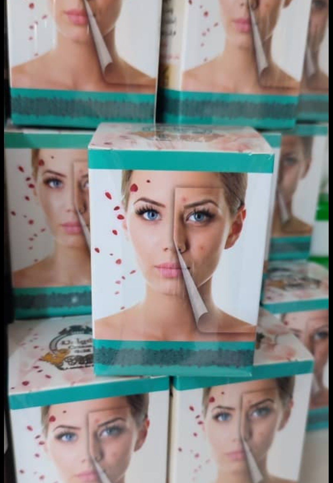 کرم ضد لک و جوش یونیک