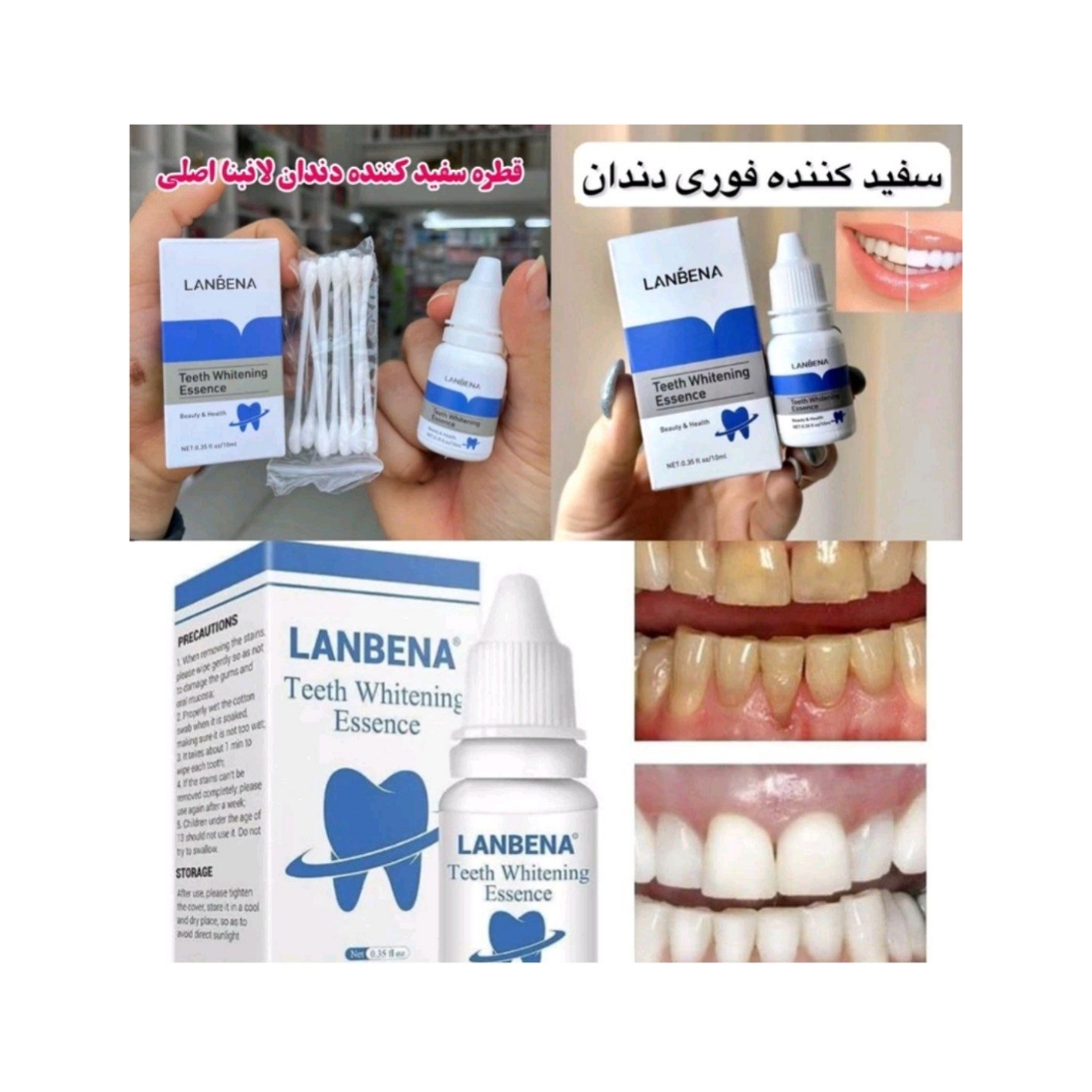قطره سفید کننده دندان اورجینال